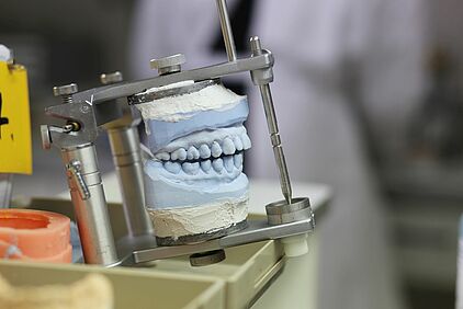Implantate und Zahnersatz